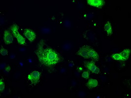 CYPOR / POR Antibody - Anti-POR mouse monoclonal antibody  immunofluorescent staining of COS7 cells transiently transfected by pCMV6-ENTRY POR.