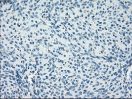 CYPOR / POR Antibody - IHC of paraffin-embedded endometrium tissue using anti-POR mouse monoclonal antibody. (Dilution 1:50).