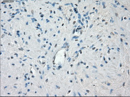 CYPOR / POR Antibody - IHC of paraffin-embedded prostate tissue using anti-POR mouse monoclonal antibody. (Dilution 1:50).