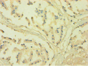 CYPOR / POR Antibody - Immunohistochemistry of paraffin-embedded human prostate tissue using POR Antibody at dilution of 1:100