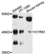 CYR61 Antibody - Western blot analysis of Jurkat cell lysate.