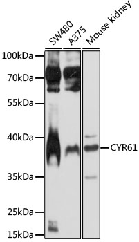 CYR61 Antibody - Western blot analysis of extracts of various cell lines, using CYR61 antibody at 1:1000 dilution. The secondary antibody used was an HRP Goat Anti-Rabbit IgG (H+L) at 1:10000 dilution. Lysates were loaded 25ug per lane and 3% nonfat dry milk in TBST was used for blocking. An ECL Kit was used for detection and the exposure time was 30s.
