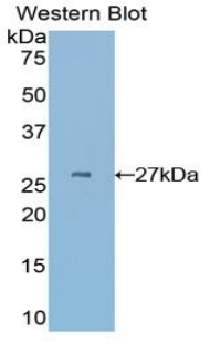 CYR61 Antibody - Western blot of recombinant CYR61.  This image was taken for the unconjugated form of this product. Other forms have not been tested.