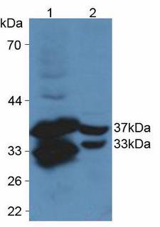 CYR61 Antibody - Western Blot; Sample: Lane1: Mouse Lung Tissue; Lane2: Mouse Liver Tissue.