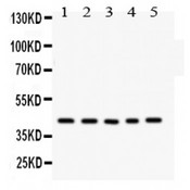 CYR61 Antibody - CCN1 antibody Western blot. All lanes: Anti CCN1 at 0.5 ug/ml. Lane 1: Rat Thymus Tissue Lysate at 50 ug. Lane 2: Rat Skeletal Muscle Tissue Lysate at 50 ug. Lane 3: A431 Whole Cell Lysate at 40 ug. Lane 4: SGC Whole Cell Lysate at 40 ug. Lane 5: 22RV1 Whole Cell Lysate at 40 ug. Predicted band size: 42 kDg. Observed band size: 42 kD.