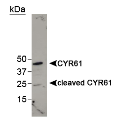 CYR61 Antibody - Detection of cleaved CYR61 in MDA-MB-231 cell lysate.  This image was taken for the unconjugated form of this product. Other forms have not been tested.