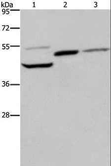 CYR61 Antibody - Western blot analysis of Mouse heart, kidney and liver tissue, using CYR61 Polyclonal Antibody at dilution of 1:350.
