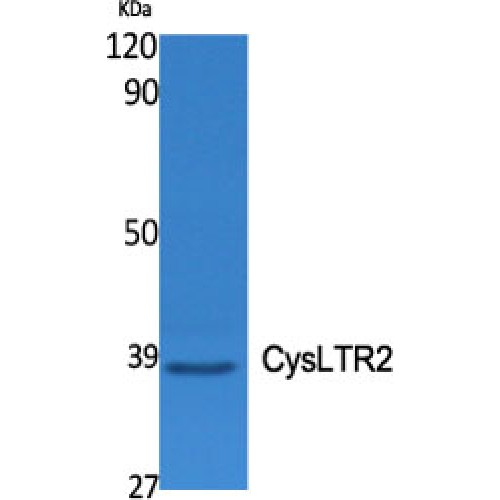 CYSLT2 / CYSLTR2 Antibody - Western blot of CysLTR2 antibody