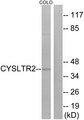 CYSLT2 / CYSLTR2 Antibody - Western blot analysis of lysates from COLO cells, using CYSLTR2 Antibody. The lane on the right is blocked with the synthesized peptide.