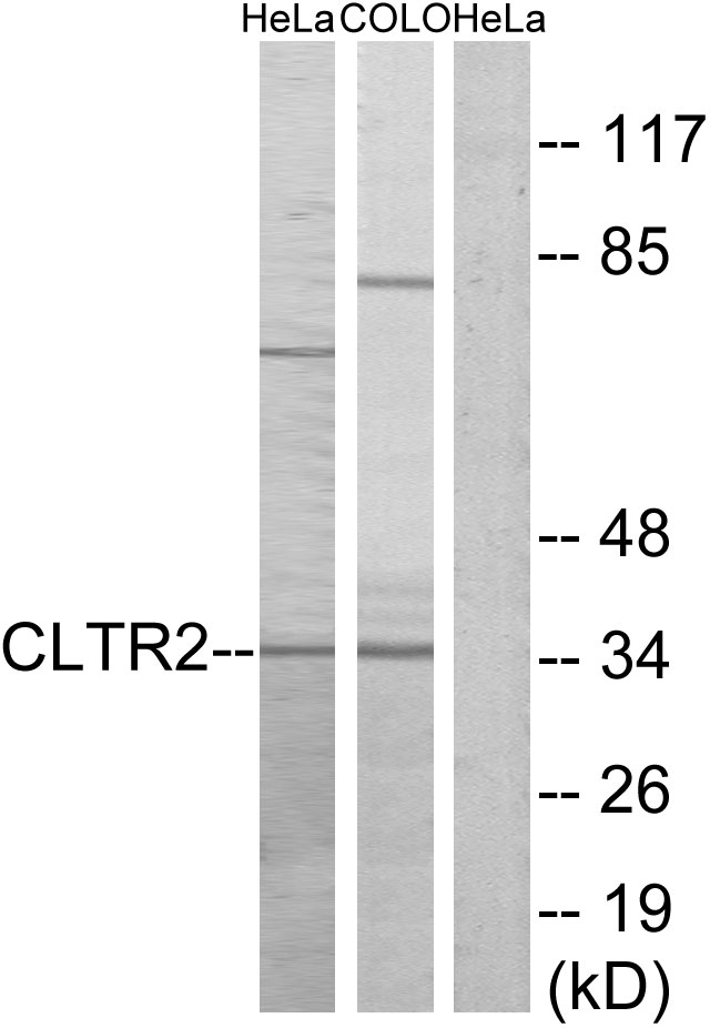 CYSLT2 / CYSLTR2 Antibody - Western blot analysis of lysates from HeLa and COLO cells, using CLTR2 Antibody. The lane on the right is blocked with the synthesized peptide.
