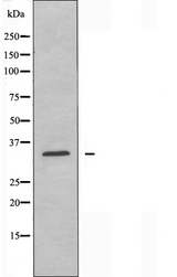CYSLT2 / CYSLTR2 Antibody - Western blot analysis of extracts of HeLa cells using CLTR2 antibody.