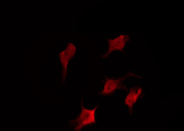 CYSLT2 / CYSLTR2 Antibody - Staining COLO205 cells by IF/ICC. The samples were fixed with PFA and permeabilized in 0.1% Triton X-100, then blocked in 10% serum for 45 min at 25°C. The primary antibody was diluted at 1:200 and incubated with the sample for 1 hour at 37°C. An Alexa Fluor 594 conjugated goat anti-rabbit IgG (H+L) Ab, diluted at 1/600, was used as the secondary antibody.