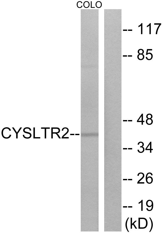 CYSLT2 / CYSLTR2 Antibody - Western blot analysis of extracts from COLO cells, using CYSLTR2 antibody.