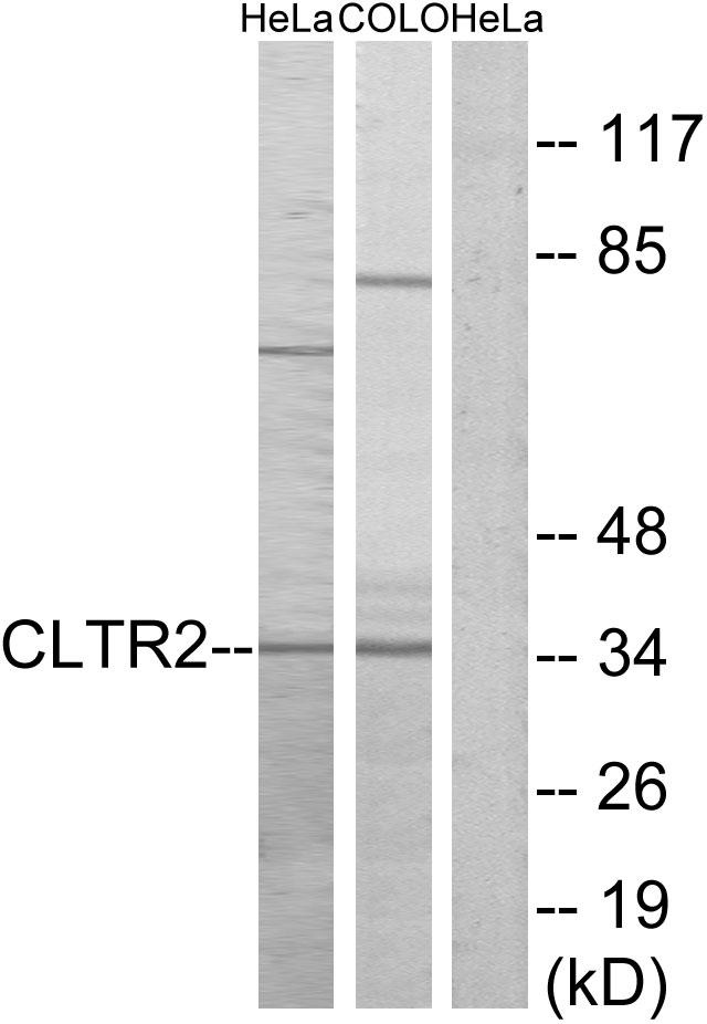 CYSLT2 / CYSLTR2 Antibody - Western blot analysis of extracts from HeLa cells and COLO cells, using CLTR2 antibody.