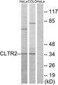 CYSLT2 / CYSLTR2 Antibody - Western blot analysis of extracts from HeLa cells and COLO cells, using CLTR2 antibody.
