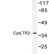 CYSLT2 / CYSLTR2 Antibody - Western blot of CysLTR2 (K322) pAb in extracts from HeLa cells.
