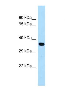 CYSLTR1 / CYSLT1 Antibody - CYSLTR1 / CYSLT1 antibody Western blot of Fetal Heart lysate. Antibody concentration 1 ug/ml.  This image was taken for the unconjugated form of this product. Other forms have not been tested.