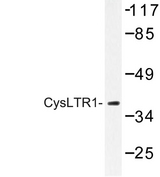 CYSLTR1 / CYSLT1 Antibody - Western blot of CysLTR1 (C173) pAb in extracts from COLO205 cells.
