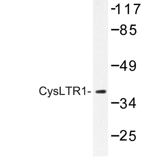 CYSLTR1 / CYSLT1 Antibody - Western blot of CysLTR1 (C173) pAb in extracts from COLO205 cells.