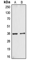CYSLTR1 / CYSLT1 Antibody - Western blot analysis of CYSLTR1 expression in A10 (A); HT29 (B) whole cell lysates.