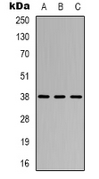 CYSLTR1 / CYSLT1 Antibody - Western blot analysis of CYSLTR1 expression in Jurkat (A); HUVEC (B); COS7 (C) whole cell lysates.