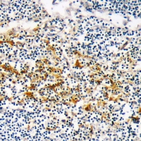 CYSLTR1 / CYSLT1 Antibody - Immunohistochemical analysis of CYSLTR1 staining in human lymph node formalin fixed paraffin embedded tissue section. The section was pre-treated using heat mediated antigen retrieval with sodium citrate buffer (pH 6.0). The section was then incubated with the antibody at room temperature and detected with HRP and DAB as chromogen. The section was then counterstained with hematoxylin and mounted with DPX.