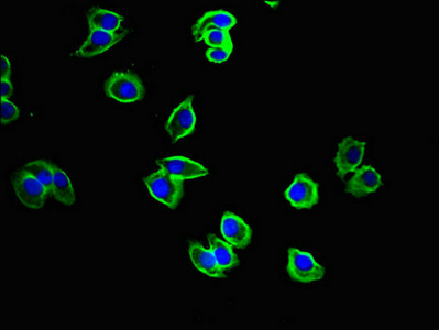 CYSLTR1 / CYSLT1 Antibody - Immunofluorescent analysis of A375 cells using CYSLTR1 Antibody at dilution of 1:100 and Alexa Fluor 488-congugated AffiniPure Goat Anti-Rabbit IgG(H+L)