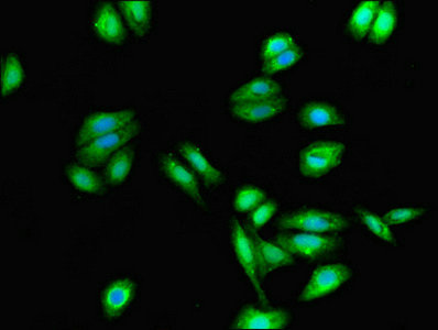 CYSLTR1 / CYSLT1 Antibody - Immunofluorescent analysis of HepG2 cells using CYSLTR1 Antibody at dilution of 1:100 and Alexa Fluor 488-congugated AffiniPure Goat Anti-Rabbit IgG(H+L)