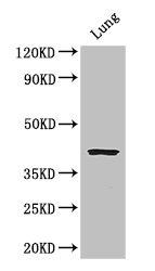 CYSLTR1 / CYSLT1 Antibody - Western Blot Positive WB detected in: Mouse lung tissue All lanes: CYSLTR1 antibody at 3µg/ml Secondary Goat polyclonal to rabbit IgG at 1/50000 dilution Predicted band size: 39 kDa Observed band size: 39 kDa