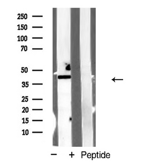 CYSLTR1 / CYSLT1 Antibody - Western blot analysis of CLTR1 expression in COS7 cells