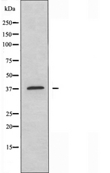 CYSLTR1 / CYSLT1 Antibody - Western blot analysis of extracts of HeLa cells using CYSLTR1 antibody.
