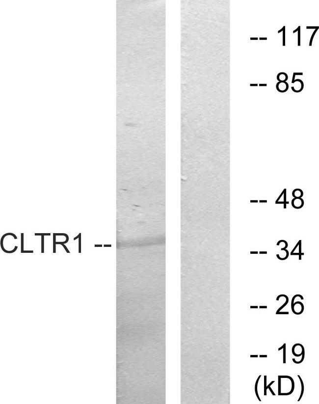 CYSLTR1 / CYSLT1 Antibody - Western blot analysis of extracts from COS7 cells, using CLTR1 antibody.