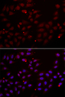 Cystatin SA / CST2 Antibody - Immunofluorescence analysis of HeLa cells.