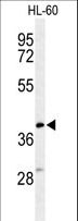 CYTB / MT-CYB Antibody - Western blot of CYTB Antibody in HL-60 cell line lysates (35 ug/lane). CYTB (arrow) was detected using the purified antibody.