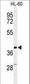 CYTB / MT-CYB Antibody - Western blot of CYTB Antibody in HL-60 cell line lysates (35 ug/lane). CYTB (arrow) was detected using the purified antibody.