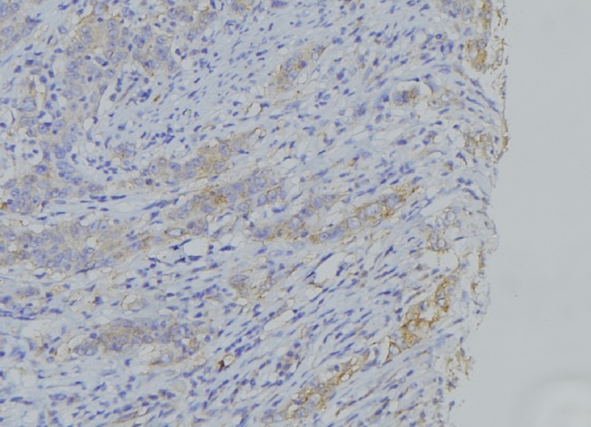 CYTB / MT-CYB Antibody - 1:100 staining human gastric tissue by IHC-P. The sample was formaldehyde fixed and a heat mediated antigen retrieval step in citrate buffer was performed. The sample was then blocked and incubated with the antibody for 1.5 hours at 22°C. An HRP conjugated goat anti-rabbit antibody was used as the secondary.