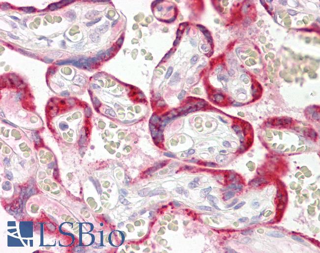 CYTB / MT-CYB Antibody - Anti-CYTB / MT-CYB antibody IHC of human placenta. Immunohistochemistry of formalin-fixed, paraffin-embedded tissue after heat-induced antigen retrieval. Antibody dilution 2.5-5 ug/ml. This image was taken for the unconjugated form of this product. Other forms have not been tested.