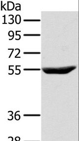 CYTH1 / Cytohesin-1 Antibody - Western blot analysis of Raji cell, using CYTH1 Polyclonal Antibody at dilution of 1:200.