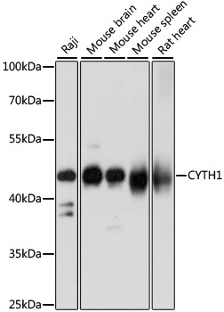 CYTH1 / Cytohesin-1 Antibody - Western blot analysis of extracts of various cell lines, using CYTH1 antibody at 1:1000 dilution. The secondary antibody used was an HRP Goat Anti-Rabbit IgG (H+L) at 1:10000 dilution. Lysates were loaded 25ug per lane and 3% nonfat dry milk in TBST was used for blocking. An ECL Kit was used for detection and the exposure time was 5s.