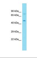CYTH2 / Cytohesin 2 Antibody - Western blot of Human MDA-MB-435S. CYTH2 antibody dilution 1.0 ug/ml.  This image was taken for the unconjugated form of this product. Other forms have not been tested.