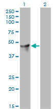 CYTH2 / Cytohesin 2 Antibody - Western blot of CYTH2 expression in transfected 293T cell line by PSCD2 monoclonal antibody (M02), clone 6H5.