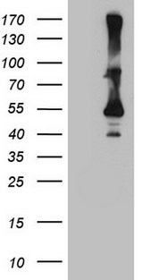 CYTH2 / Cytohesin 2 Antibody - HEK293T cells were transfected with the pCMV6-ENTRY control. (Left lane) or pCMV6-ENTRY CYTH2. (Right lane) cDNA for 48 hrs and lysed. Equivalent amounts of cell lysates. (5 ug per lane) were separated by SDS-PAGE and immunoblotted with anti-CYTH2. (1:2000)