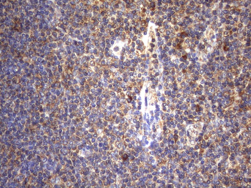 CYTH2 / Cytohesin 2 Antibody - Immunohistochemical staining of paraffin-embedded Human tonsil within the normal limits using anti-CYTH2 mouse monoclonal antibody. (Heat-induced epitope retrieval by 1mM EDTA in 10mM Tris buffer. (pH8.5) at 120°C for 3 min. (1:150)