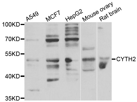 CYTH2 / Cytohesin 2 Antibody - Western blot analysis of extracts of various cell lines.