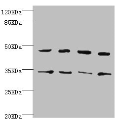 CYTH2 / Cytohesin 2 Antibody - Western blot All Lanes:CYTH2 antibody at 5.58ug/ml Lane 1:U251 whole cell lysate Lane 2:HepG2 whole cell lysate Lane 3:MCF-7 whole cell lysate Lane 4:A549 whole cell lysate Secondary Goat polyclonal to rabbit at 1/10000 dilution Predicted band size: 47kDa Observed band size: 47kDa,35kDa (We are unsure as to the identity of this extra band)