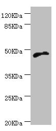 CYTH2 / Cytohesin 2 Antibody - Western blot All Lanes:CYTH2 antibody at 5.1ug/ml+MCF-7 whole cell lysate Secondary Goat polyclonal to rabbit at 1/10000 dilution Predicted band size: 47kDa Observed band size: 47kDa