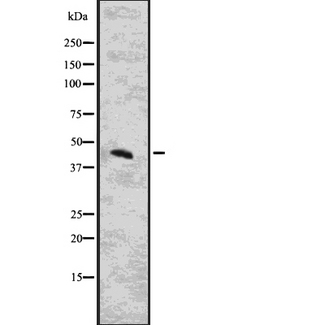 CYTH3 / GRP1 Antibody - Western blot analysis of CYTH3 using COLO205 whole lysates.