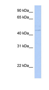 CYTH4 / PSCD4 Antibody - CYTH4 / PSCD4 antibody Western blot of Fetal Liver lysate. This image was taken for the unconjugated form of this product. Other forms have not been tested.