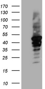CYTH4 / PSCD4 Antibody - HEK293T cells were transfected with the pCMV6-ENTRY control. (Left lane) or pCMV6-ENTRY CYTH4. (Right lane) cDNA for 48 hrs and lysed
