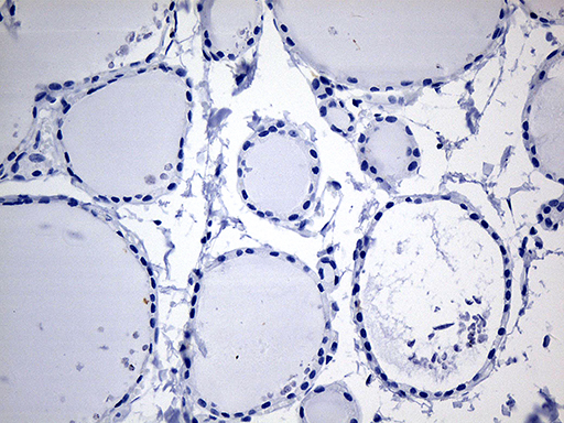 CYTH4 / PSCD4 Antibody - Immunohistochemical staining of paraffin-embedded Human thyroid tissue within the normal limits using anti-CYTH4 mouse monoclonal antibody. This figure shows negative staining. (Heat-induced epitope retrieval by 1mM EDTA in 10mM Tris buffer. (pH8.5) at 120°C for 3 min. (1:150)